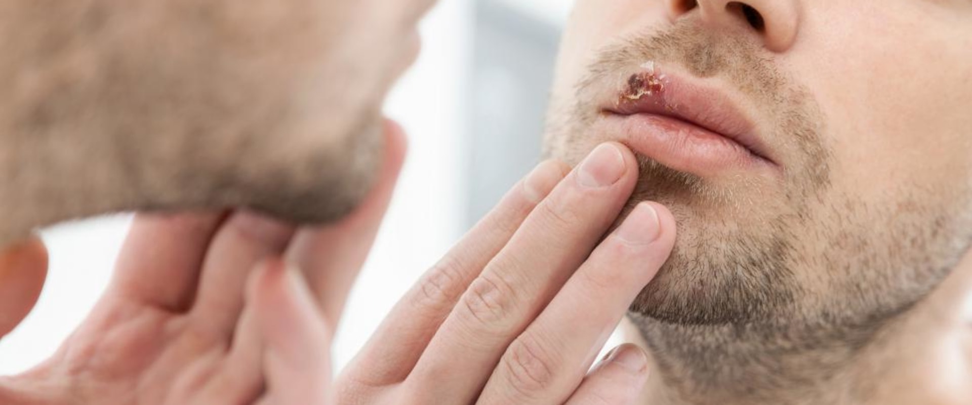 Are We Any Closer to a Cure for Herpes?