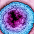 Why Herpes is Incurable: An Expert's Perspective