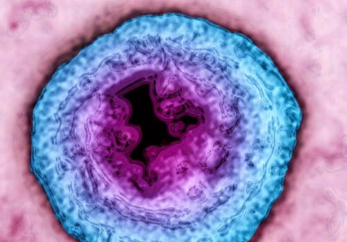 Why Can't We Cure Herpes Yet?